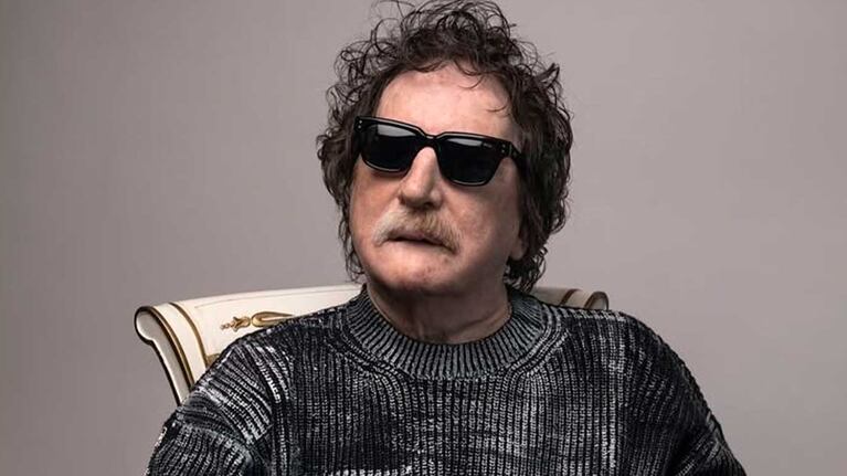 Operaron a Charly García para quitarle una parte del riñón: cuál es su estado de salud