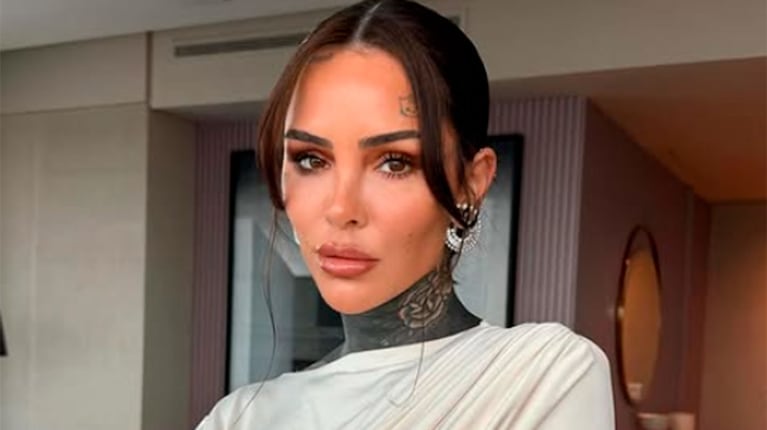 Cande Tinelli sufrió un accidente y será operada
