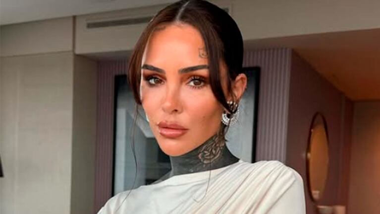 Cande Tinelli sufrió un accidente y será operada