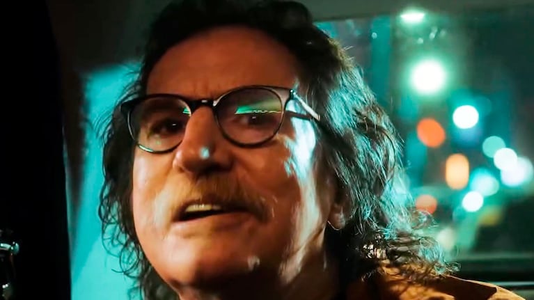 Cómo está Charly García tras su cirugía de riñón: el comunicado oficial sobre su salud