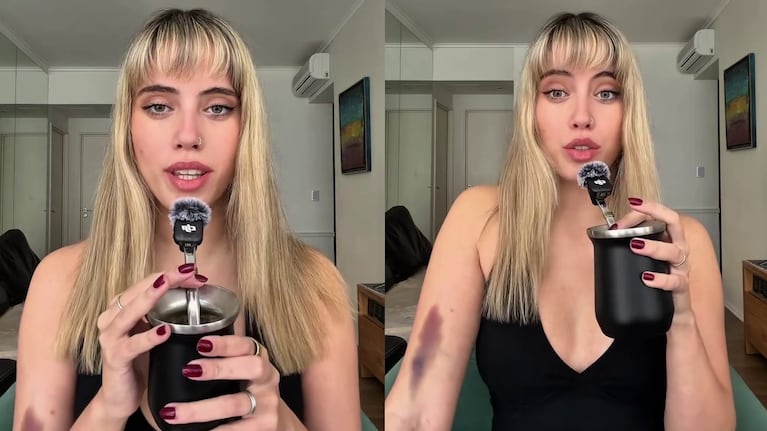 Denisse González mostró los fuertes efectos colaterales de los tratamientos