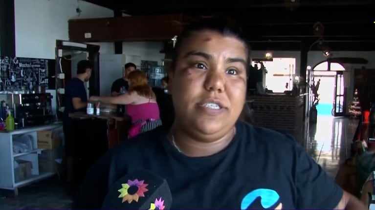 De qué vive Camilota tras salir de Cuestión de Peso: “Mi meta es comprarme los audífonos”