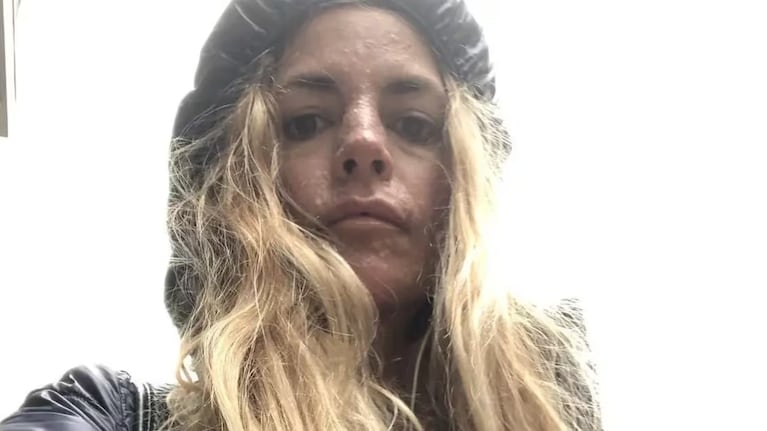 El desesperado pedido de Sonsoles Rey, ahijada de Sandra Mihanovich, en busca de su tercer trasplante
