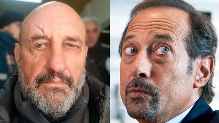 El Puma Goity se habría agarrado a piñas en el teatro: la intervención de Guillermo Francella y la Policía