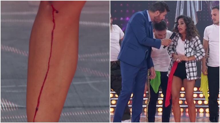 Lourdes Sánchez culminó su performance en el Súper Bailando con la rodilla lastimada