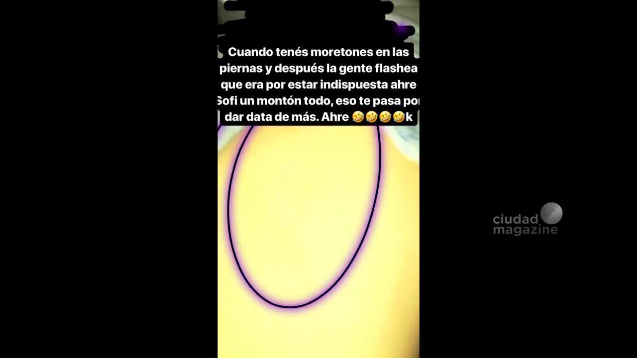Moretones.mp4