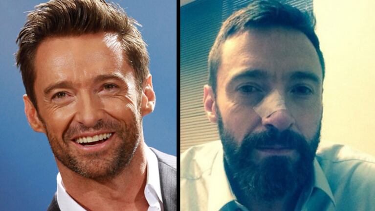 Hugh Jackman con su herida post operatoria (Fuente:Web)