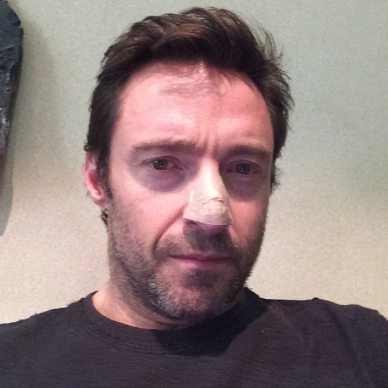 Hugh Jackman se operó de cáncer de piel: la foto que publicó en Instagram 