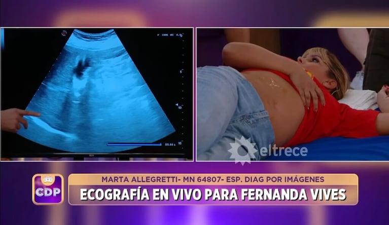 Impacto en Cuestión de Peso: a Fernanda Vives le detectaron un problema de salud en vivo | Créditos: Captura El Trece