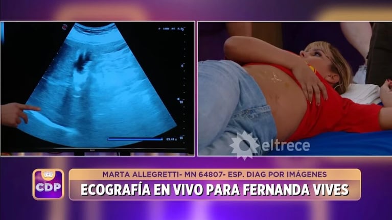 Impacto en Cuestión de Peso: a Fernanda Vives le detectaron un problema de salud en vivo | Créditos: Captura El Trece
