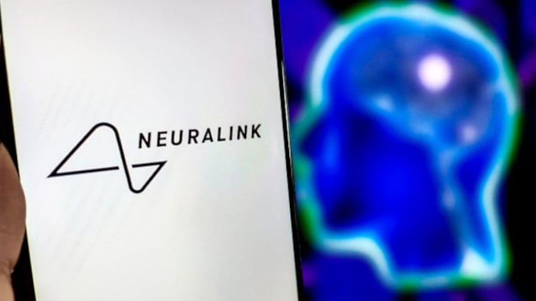 Implantes cerebrales para mejorar la experiencia en juegos: los detalles del novedoso desafío de Valve