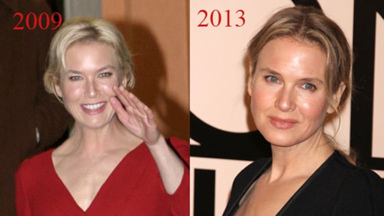 Irreconocible: El radical cambio de Renée Zellweger. (Foto: Revista ¡Hola! España)