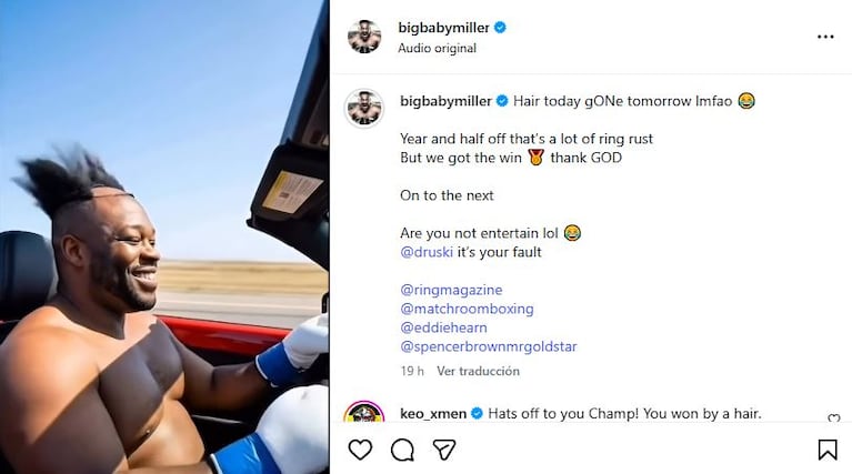 Jarrell “Big Baby” Miller perdió el peluquín en plena pelea y bromeó en sus redes sociales (Foto: Instagram @bigbabymiller)
