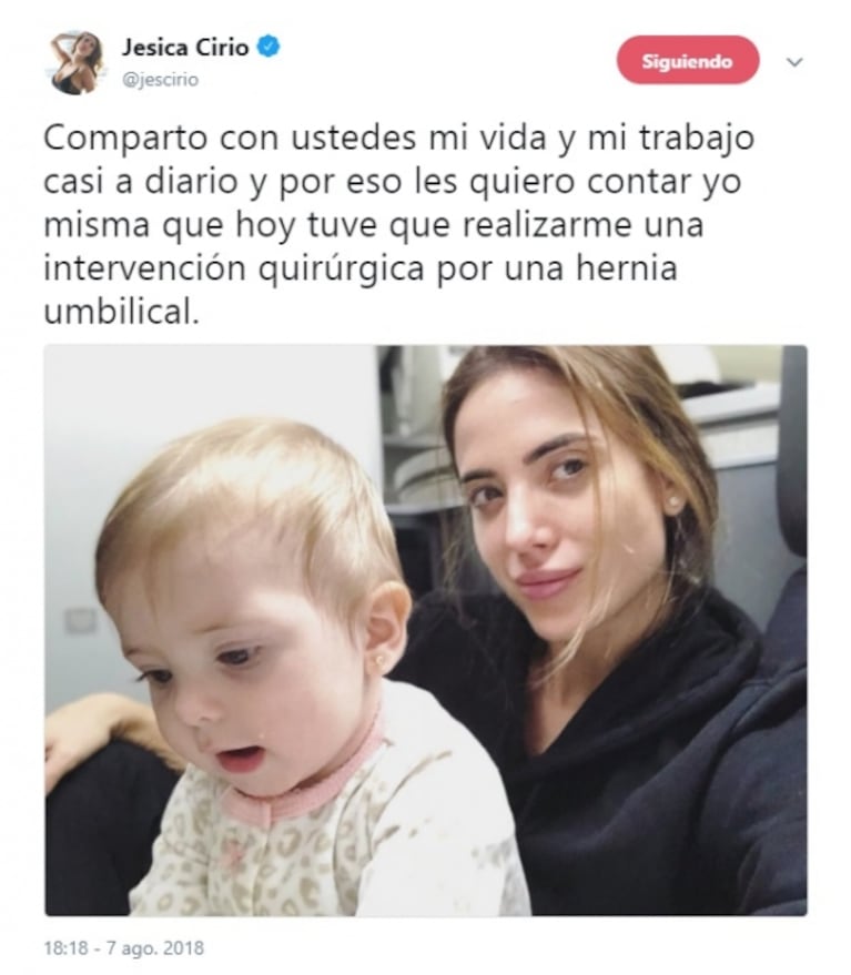 Jésica Cirio fue operada de una hernia umbilical: "Estoy muy bien, pero tengo que hacer reposo varios días"