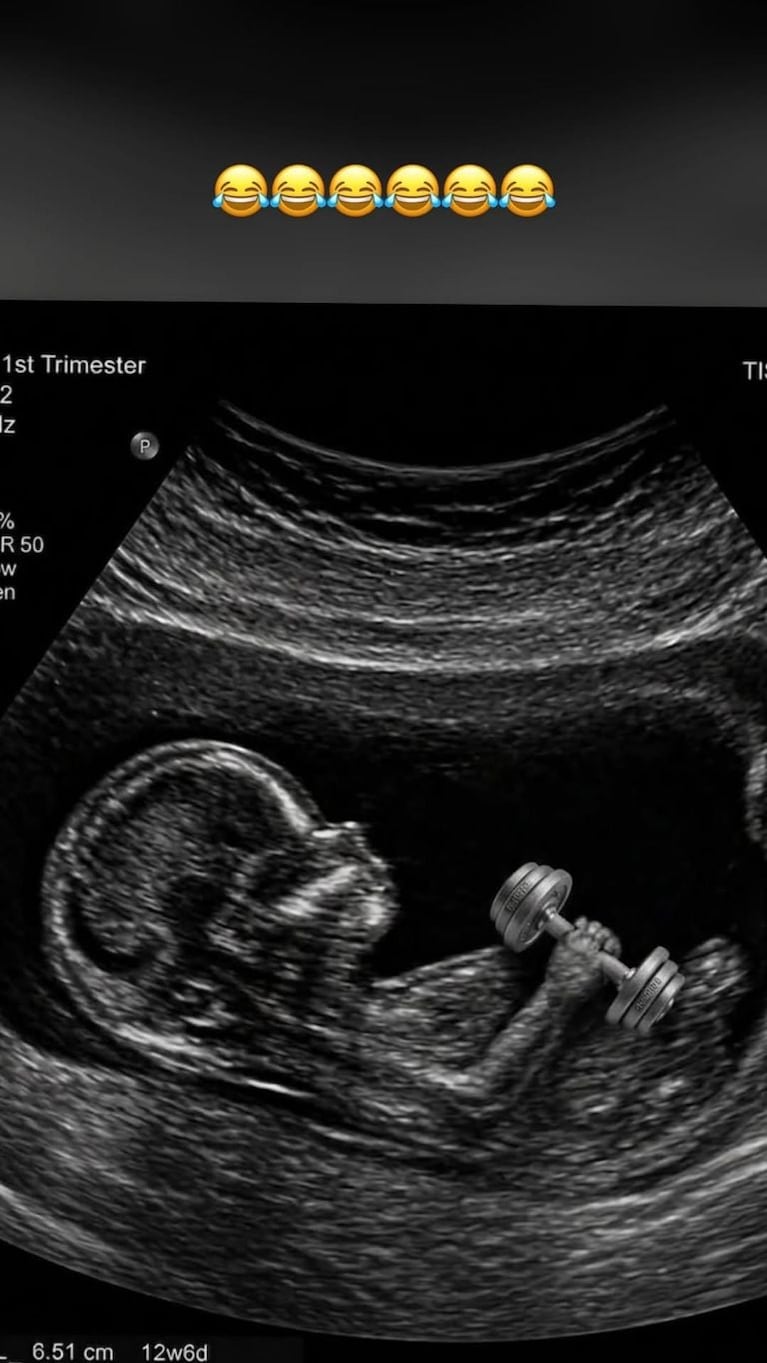 Jésica Cirio mostró una tierna ecografía de su bebé y sorprendió con un divertido detalle. Crédito: Instagram