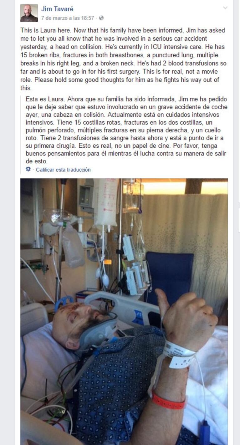 Jim Tavaré, el actor de Harry Potter, en grave estado tras sufrir un accidente automovilístico 