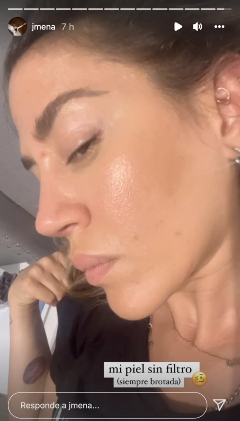 Jimena Barón hizo detox y se quejó porque le empeoró la piel: "Estoy sin filtro, re grasosa"
