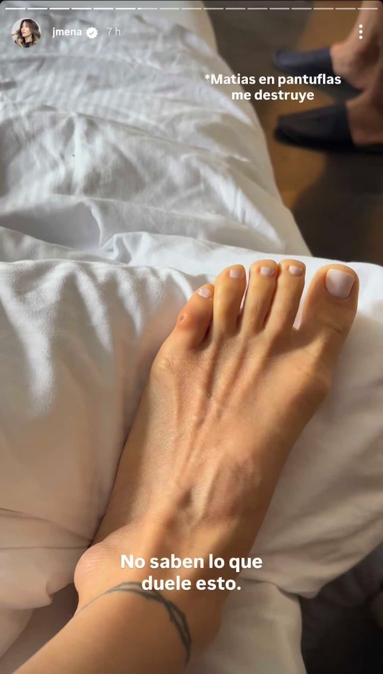 Jimena Barón mostró la lastimadura que se hizo en el pie. (Foto: Instagram/jmena)