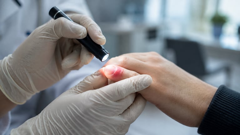 Jorge Ángel Heras, enfermero: “Se puede terminar en el hospital sólo por comerse las uñas". Foto: IA