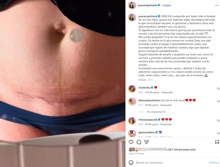 Juana Repetto reflexionó sobre su cuerpo tras dar a luz a su tercer hijo (Foto de Instagram @juanarepettook)