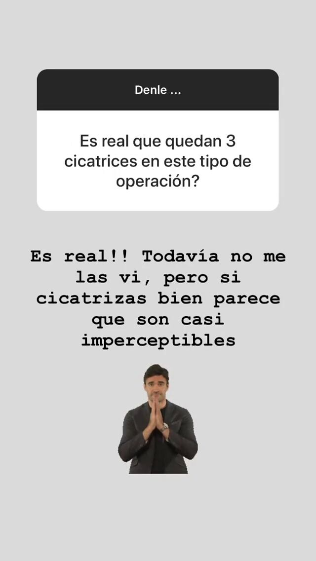 Juana Repetto se hizo las lolas y contó en Instagram por qué tomó la decisión: "Amamanté 3 años y me quedaron muy mal"