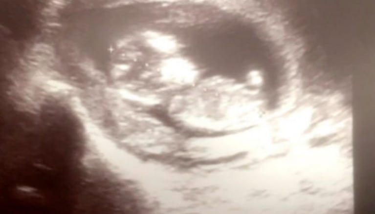 Julia Mengolini anunció su embarazo usando lenguaje inclusivo: "Dentro de unos meses va a ser mi hijitx"