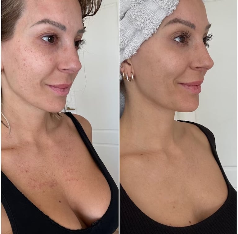 "¡Juro por mis hijos que esto NO tiene edición! El cambio es real", escribió Noelia junto a la comparación de las fotos.

Crédito: Instagram @noeliamarzolok
