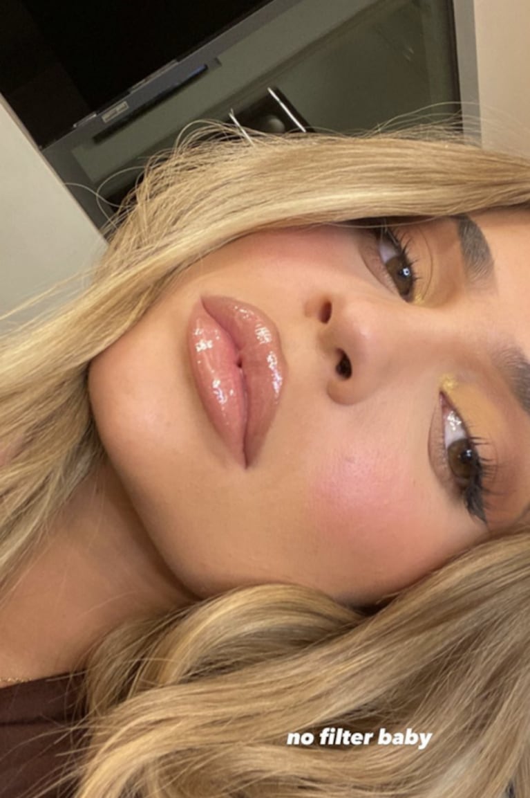 Kylie Jenner compartió una foto de su rostro sin retoques digitales y se volvió viral: "Sin filtro, bebé"