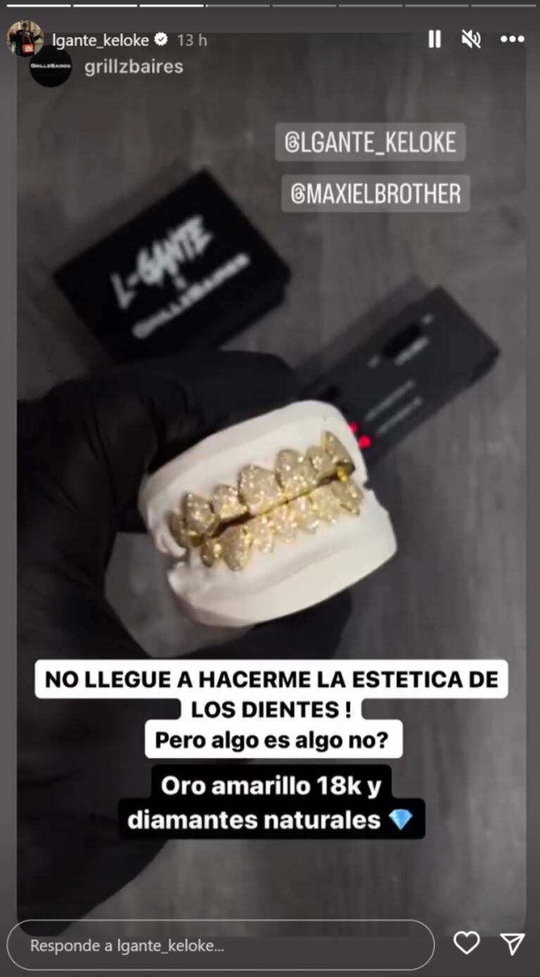 L-Gante mostró su dentadura postiza de oro de 18 kilates y diamantes: "No llegué a hacerme la estética en los dientes"