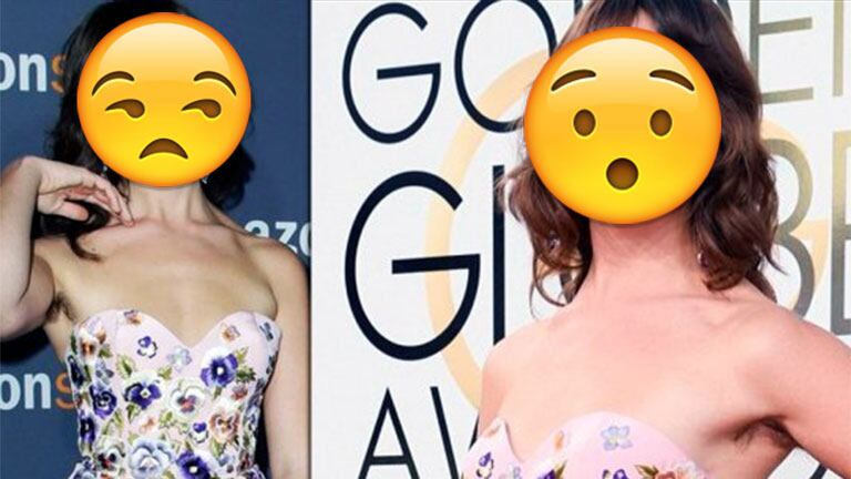 La actriz que se mostró con sus axilas al natural en los Golden Globes. Fotos: Web.