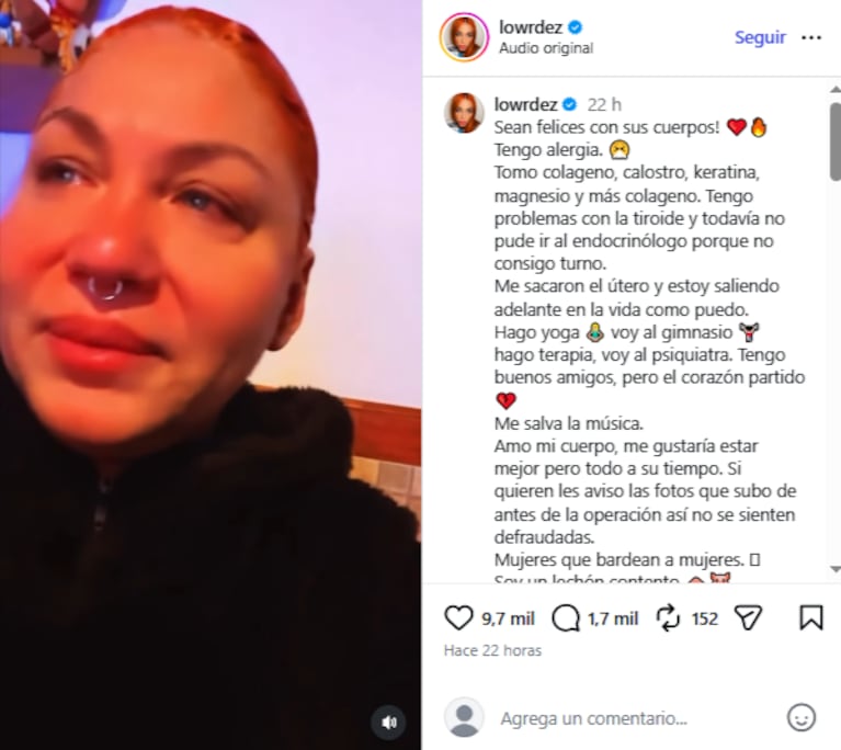 La artista  mencionó que tiene alergia y que su corazón está "partido", pero que la música la salva.  Crédito Instagram