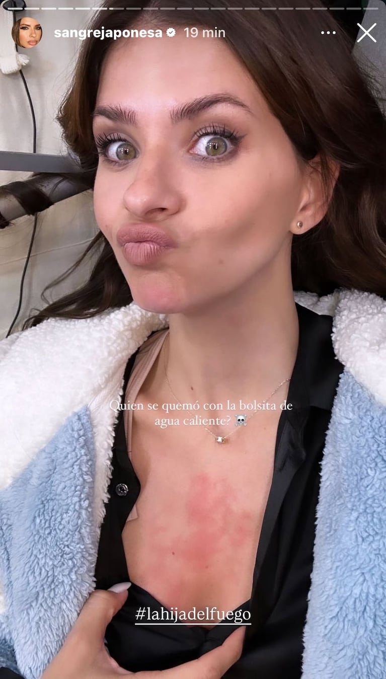 La China Suárez se quedó dormida con la bolsa de agua caliente durante el rodaje de La Hija del Fuego (Foto: captura de Instagram/@sangrejaponesa).