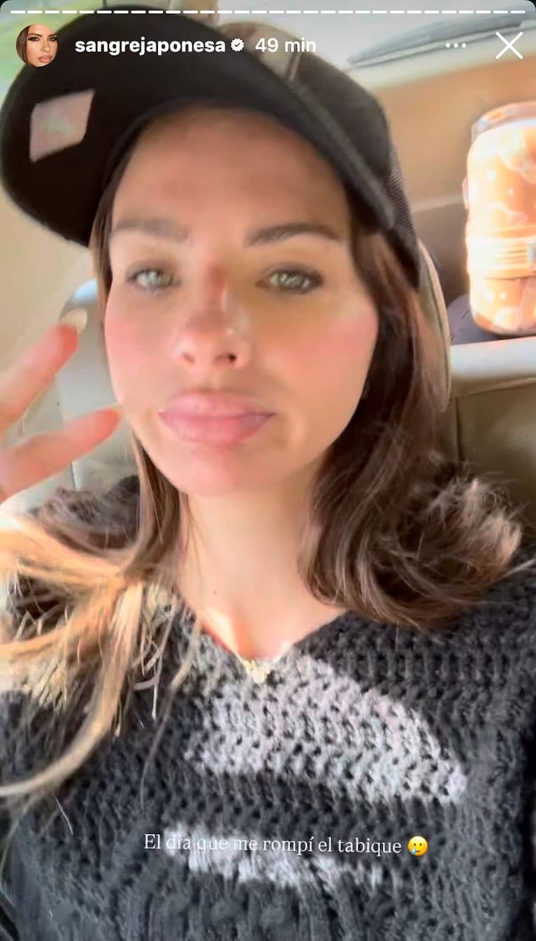 La China Suárez se rompió el tabique en pleno rodaje de La Hija del Fuego (Foto: Instagram/@sangrejaponesa).