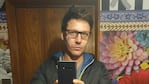 La cicatriz de Benjamín Vicuña | Créditos: Instagram @benjaminvicuna.ok