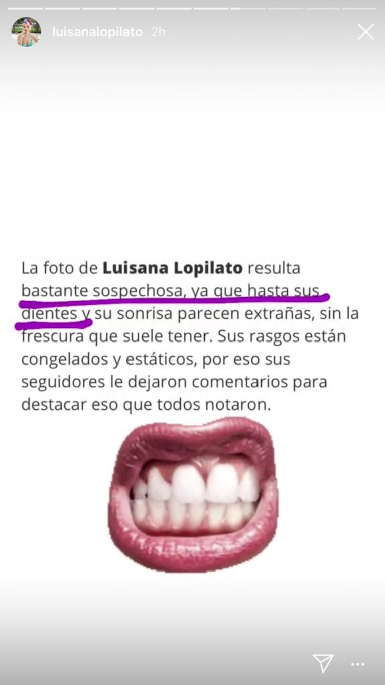 La divertida reacción de Luisana Lopilato, luego de que especularan con un paso por el quirófano: "¿De verdad, chiques?"