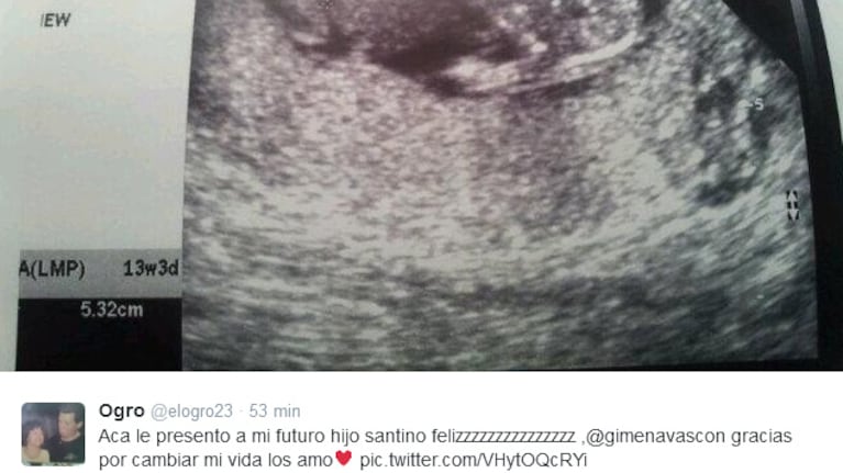 La ecografía de Santino, el hijo del Ogro Fabbiani. (Foto: @elogro23)
