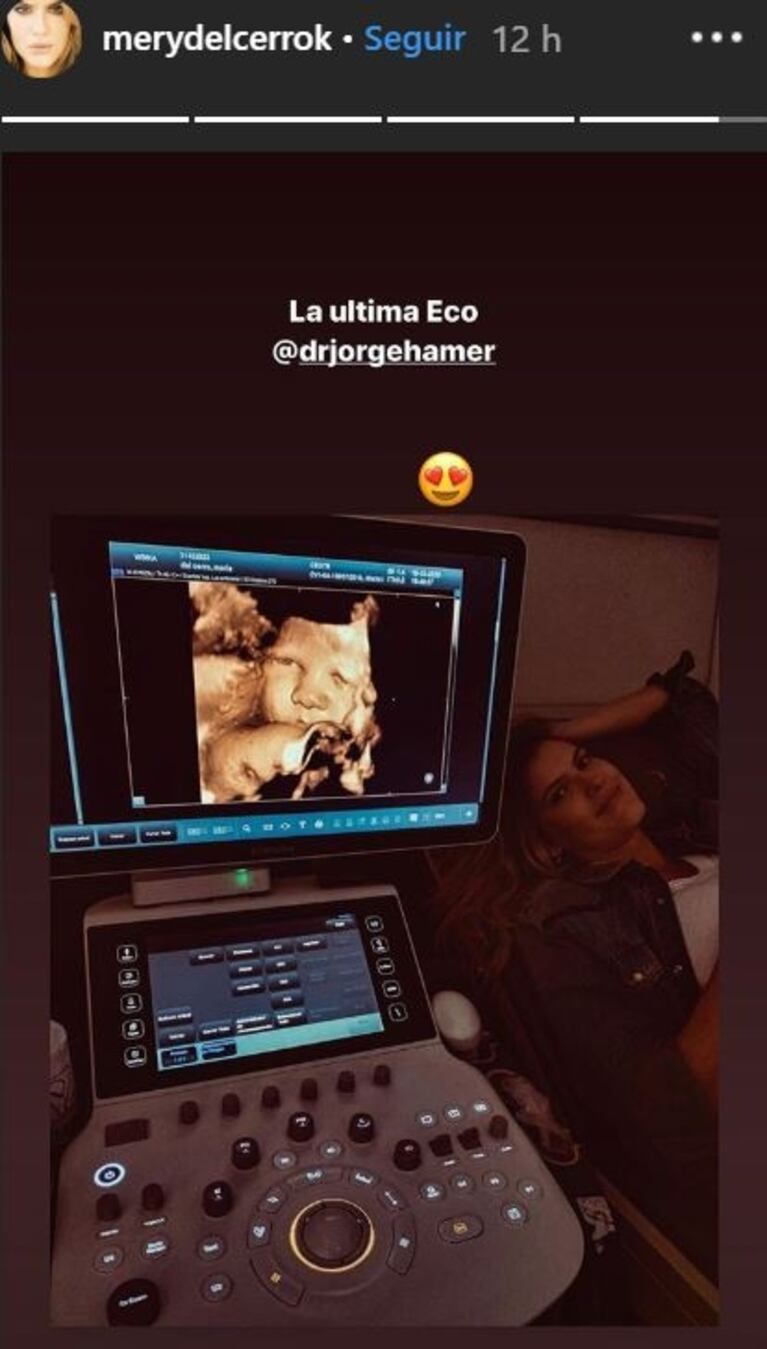La emoción de Mery del Cerro al ver la ecografía de su beba en camino: "¡Una linda dentro de toda esta locura!"