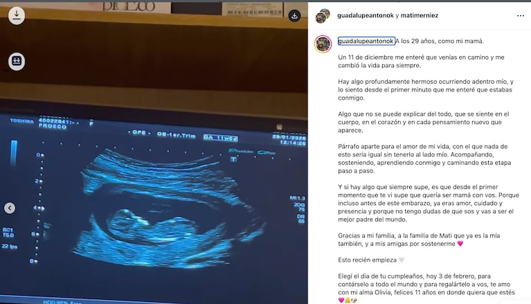 La exestrella de Casi Ángeles Guadalupe Antón espera su primer hijo: el anuncio que conmovió a todos