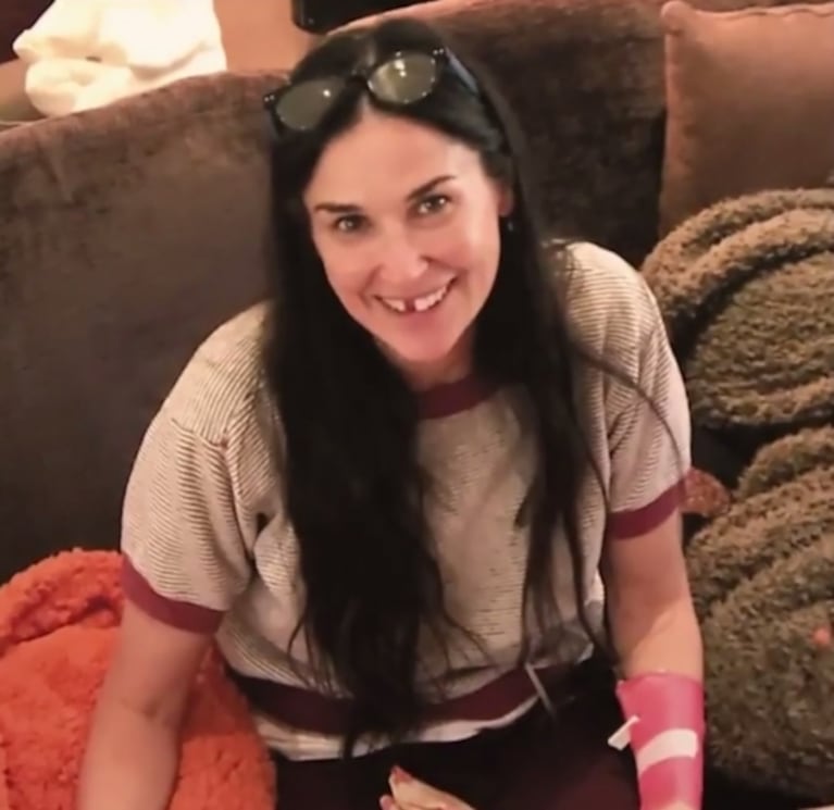 La extraña razón por la que Demi Moore perdió dos dientes frontales: "Me encantaría decir que sucedió mientras hacía skate, pero fue por el estrés"