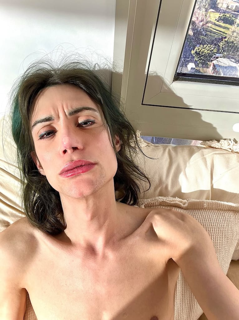 La extrema delgadez de Felipe Pettinato (Foto: Instagram @felipettinato)