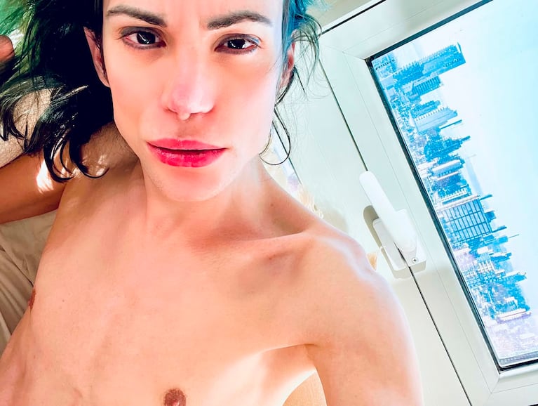 La extrema delgadez de Felipe Pettinato (Foto: Instagram @felipettinato)