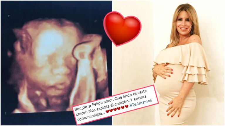 La foto de la ecografía del hijo de Flor Peña posando como un "contorsionista" (Fotos: Instagram)