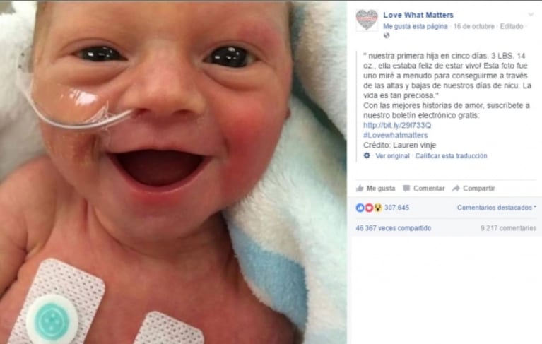 La foto de una beba seismesina sonriendo en una incubadora que enternece al mundo: ¡mirá cómo está ella hoy con 2 años!