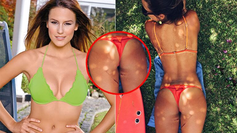 La foto en colaless de Luli Fernández... con dolorosas heridas tras un día de surf (Foto: web)