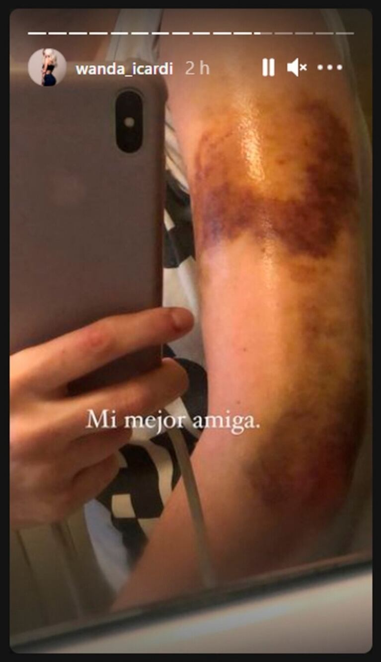 La mamá de Wanda Nara “retó” a su hija por mostrar fotos de la familia accidentada: “La gente se preocupa”