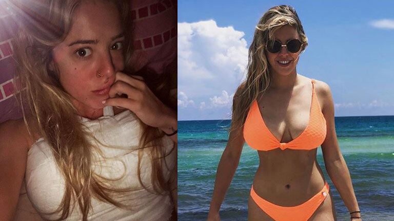 La primera foto de Nati Jota tras la cirugía para sacarse lolas: Cuando no tenés ni idea cómo te van a quedar