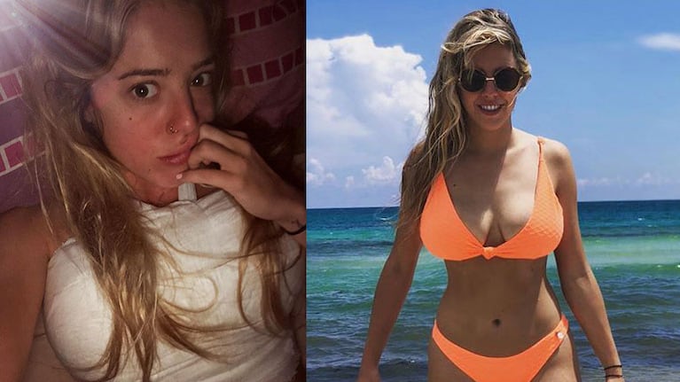 La primera foto de Nati Jota tras la cirugía para sacarse lolas: Cuando no tenés ni idea cómo te van a quedar