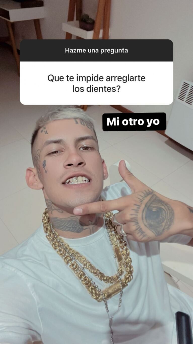 La reacción de L-Gante cuando le preguntaron por qué no se arregla los dientes