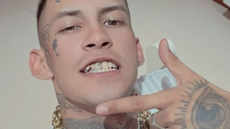 La reacción de L-Gante cuando le preguntaron por qué no se arregla los dientes