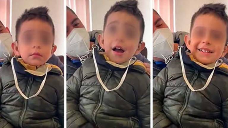 La reacción de un niño con discapacidad auditiva al escuchar por primera vez la voz de su padre